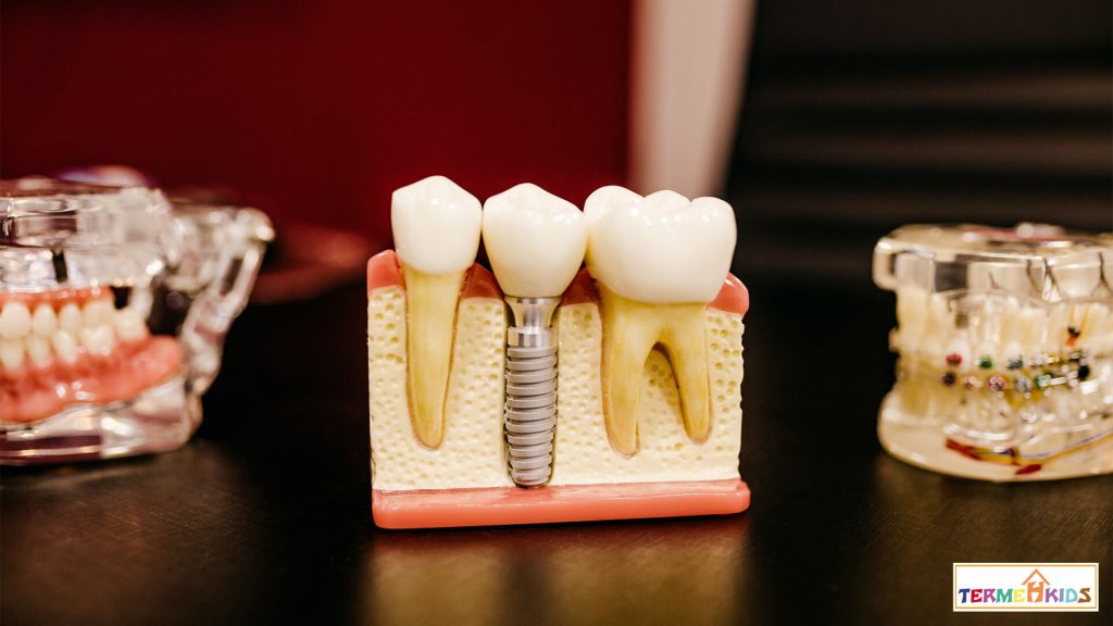 پوسیدگی دندان در کودکان Tooth decay in children Termeh Kids 3 1024x576 - پوسیدگی دندان در کودکان